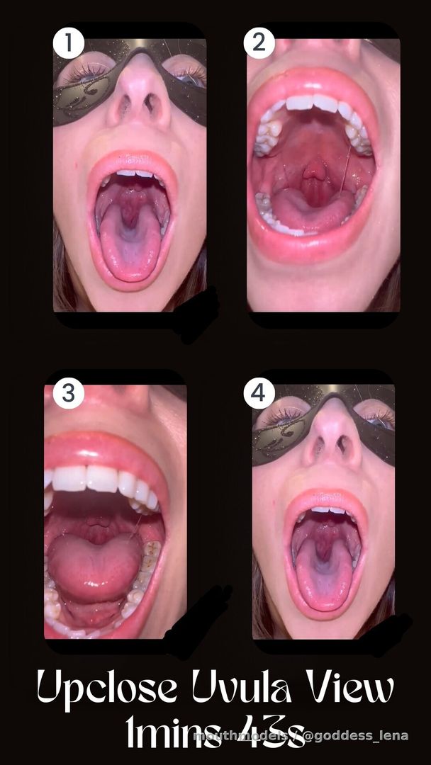 Upclose interior view of my mouth 😛