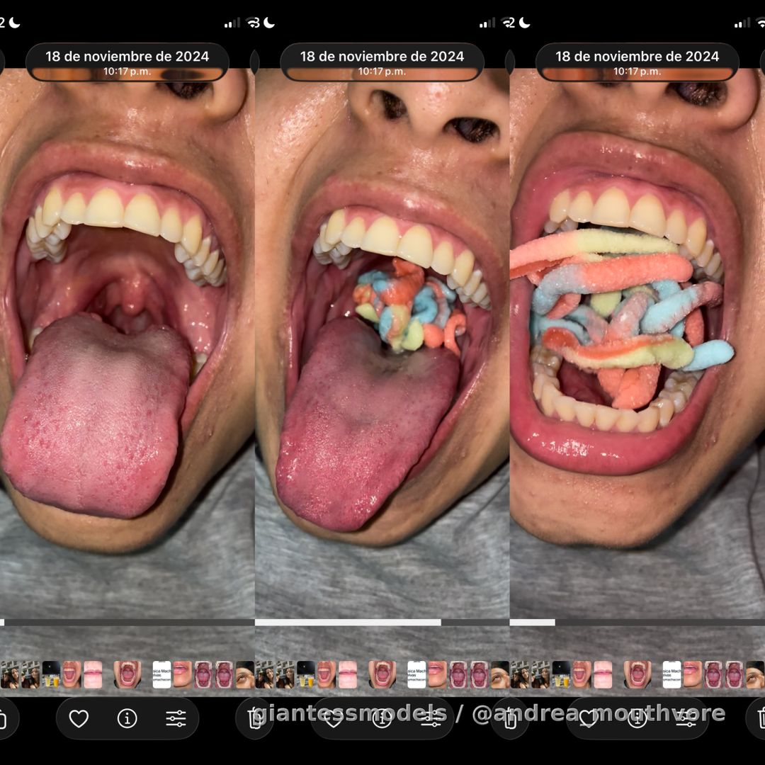 I swallow 20 gummy worms