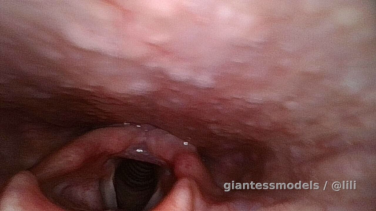 some preview pictures