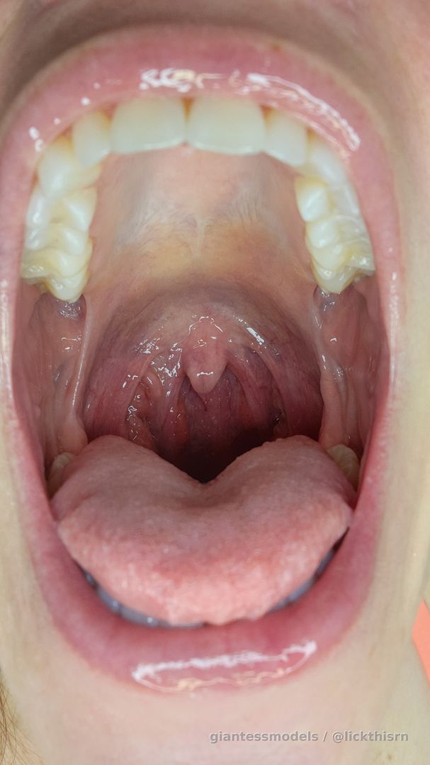 Uvula Lovers unite! 7 pics, 4 close view. 