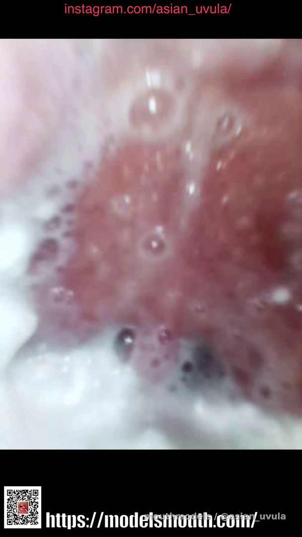 HD endoscope with food