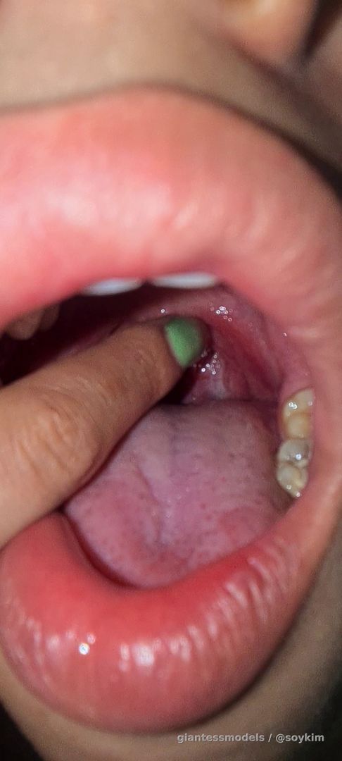 Bostezos y arcadas👄
Yawning and gag