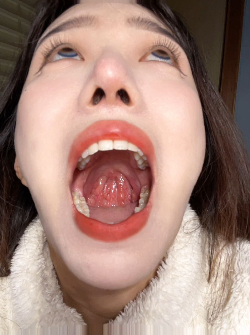 A female college student showed her mouth and swallowed a rope.