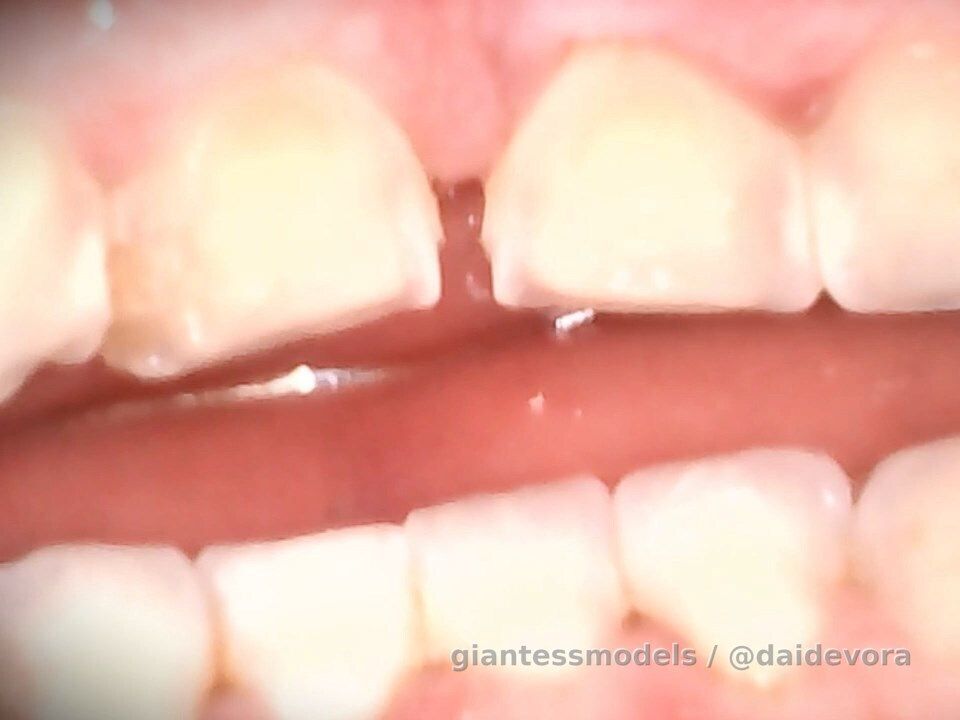 Reverse Endo #1 - ENDOSCOPE ONLY!!! NO NUDITY!!!
-----
Indulge in my latest vore-filled escapade 📺👀, where I'll be 
exploring the depths of my own mouth and throat using an endoscope 🤯. Get ready for a reverse view of my oral cavity, as well as an exclusive look at my nasal canal and the back of my throat 🔍🌟👑. Will you be my next meal? 🤔
------
Reverse Endo #1 - ENDOSCOPE ONLY!!!