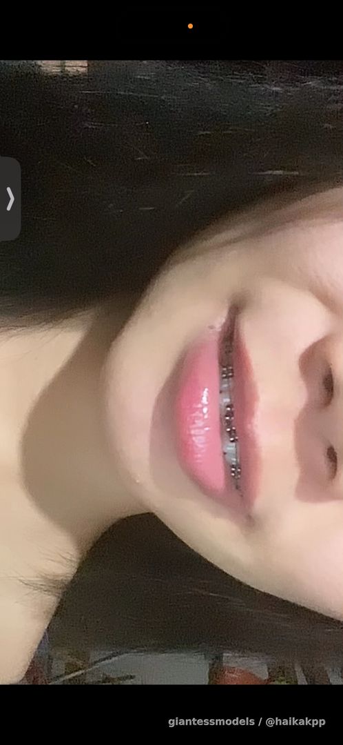 Girl show her uvula