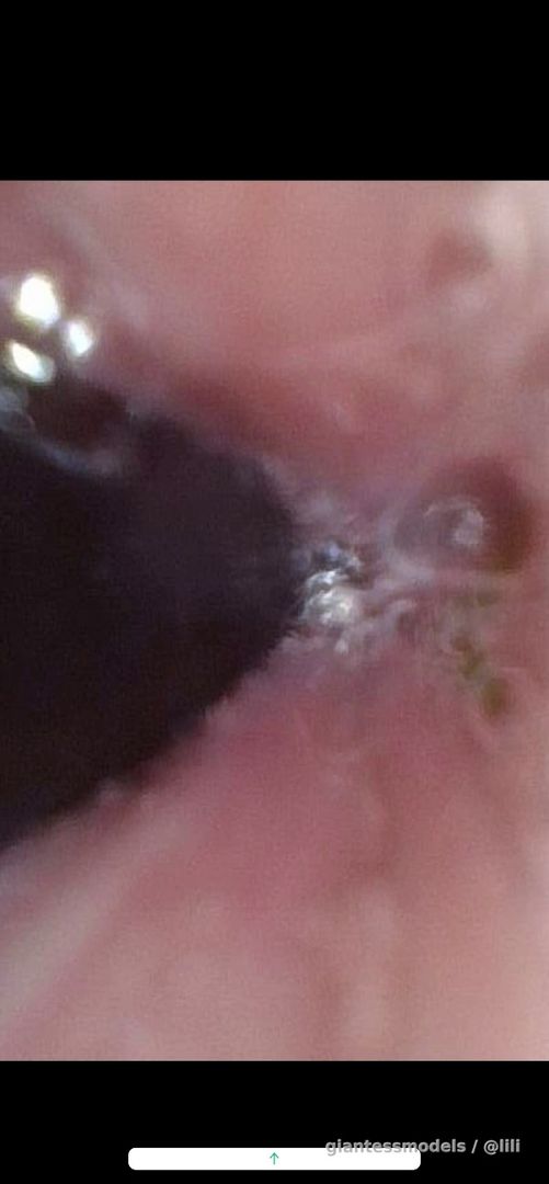 28 minutes of endoscopic food digestion (endoscope only)