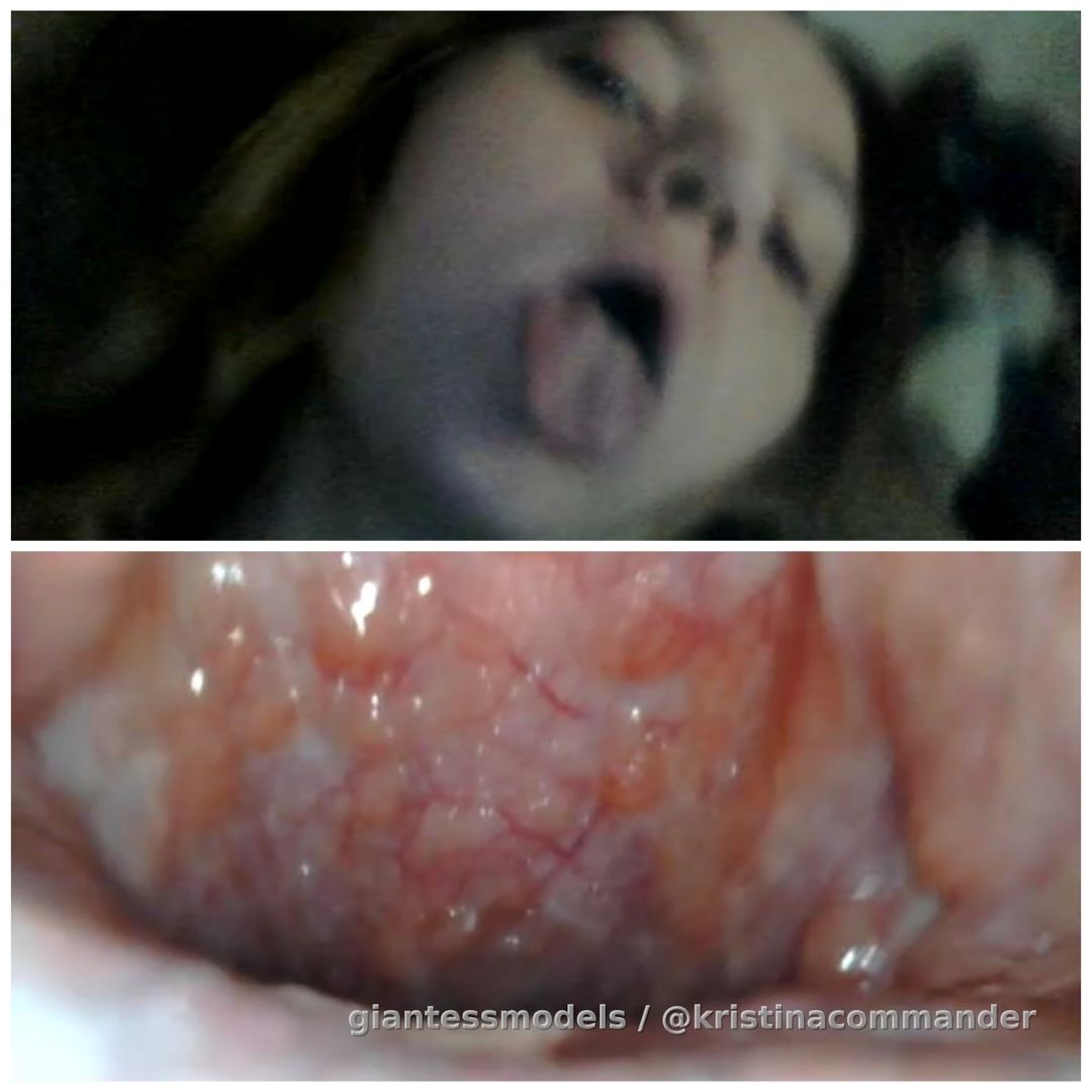 Endoscope throat (4:30 mins video)
