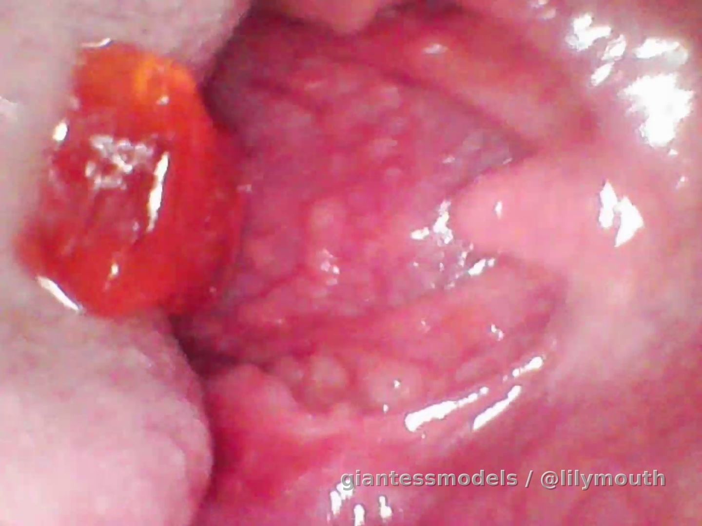 Gummy swallow with my new endoscope