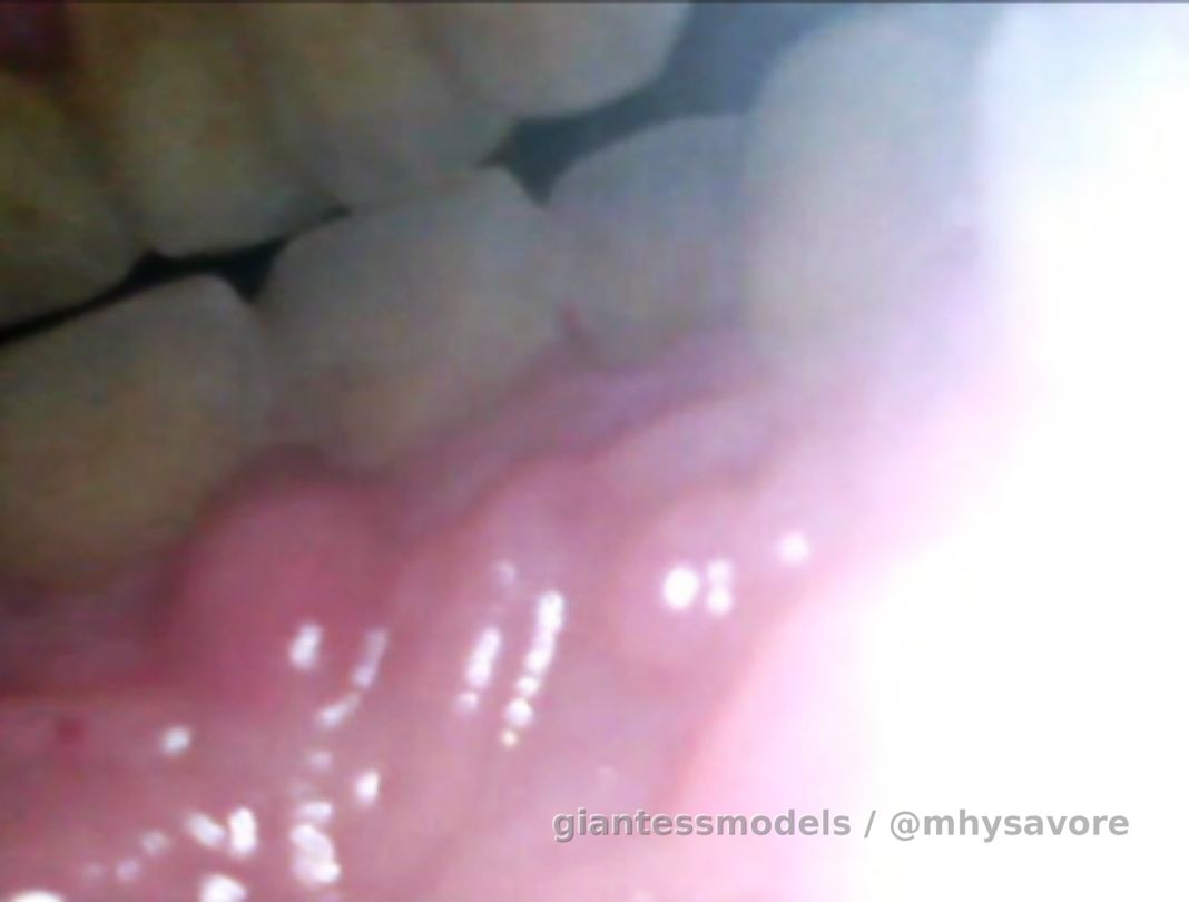 New reverse endoscopy footage! Just a teaser at this point you want more puddin's?
DM me you buy more more more 😁🦷🦷😁
I have nails the previews app yet what with everything going on I'm my personal life but these a two screenshot or the kind of view you'll be getting xx