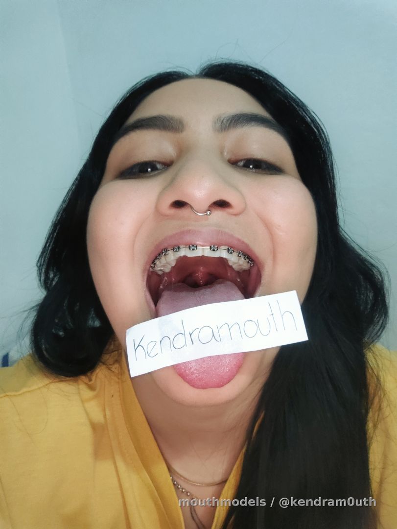 6 photos of my mouth