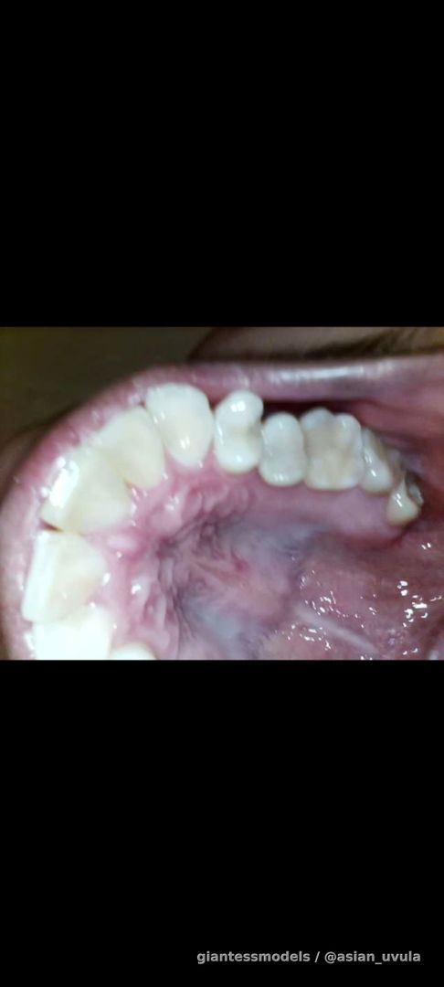 Endoscope view, palette view, deep throat view