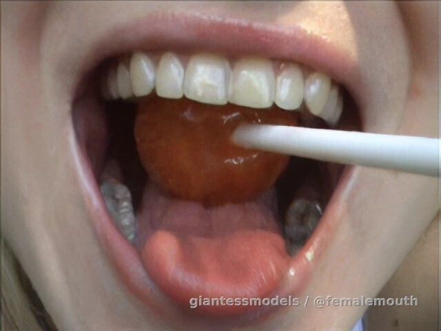 Classic - beautiful teeth VS a lollipop!