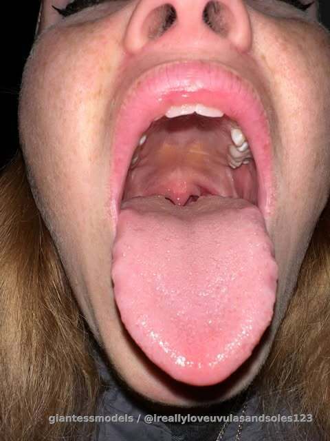 Here’s a pic from a girl on instagram 