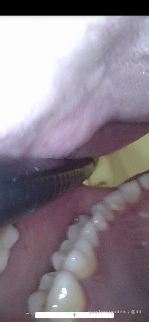 Tube swallowed with endoscope