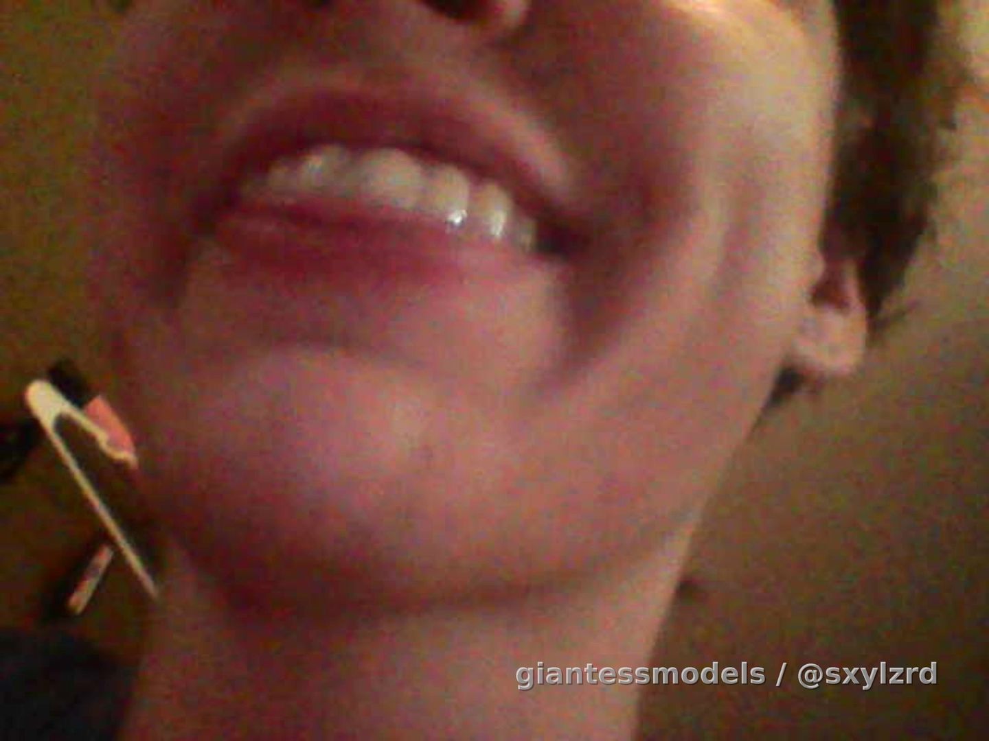 Endo Slobber Fun