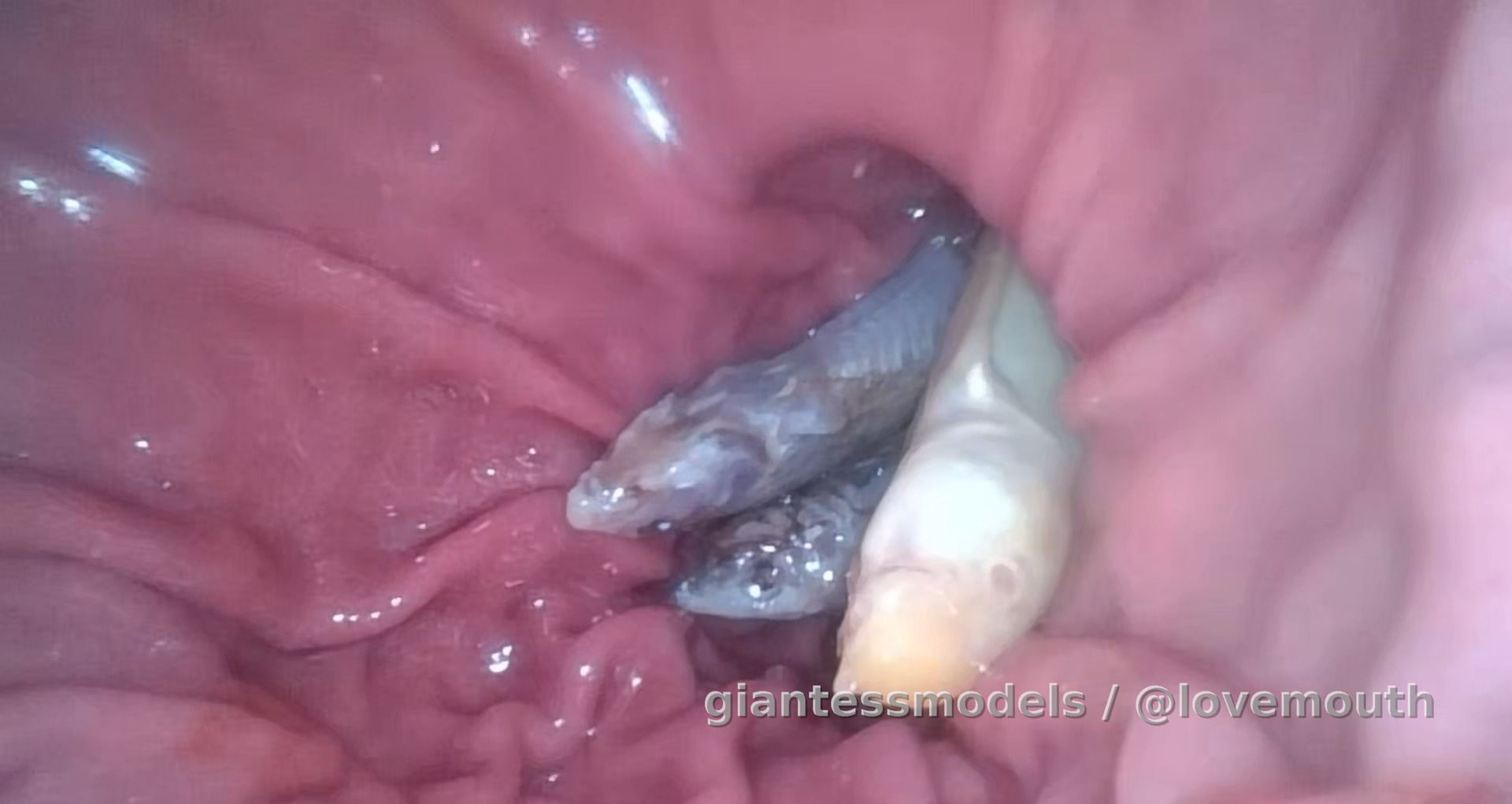 A girl swallows a live loach and observes its digestion via endoscopy.（1h20min）