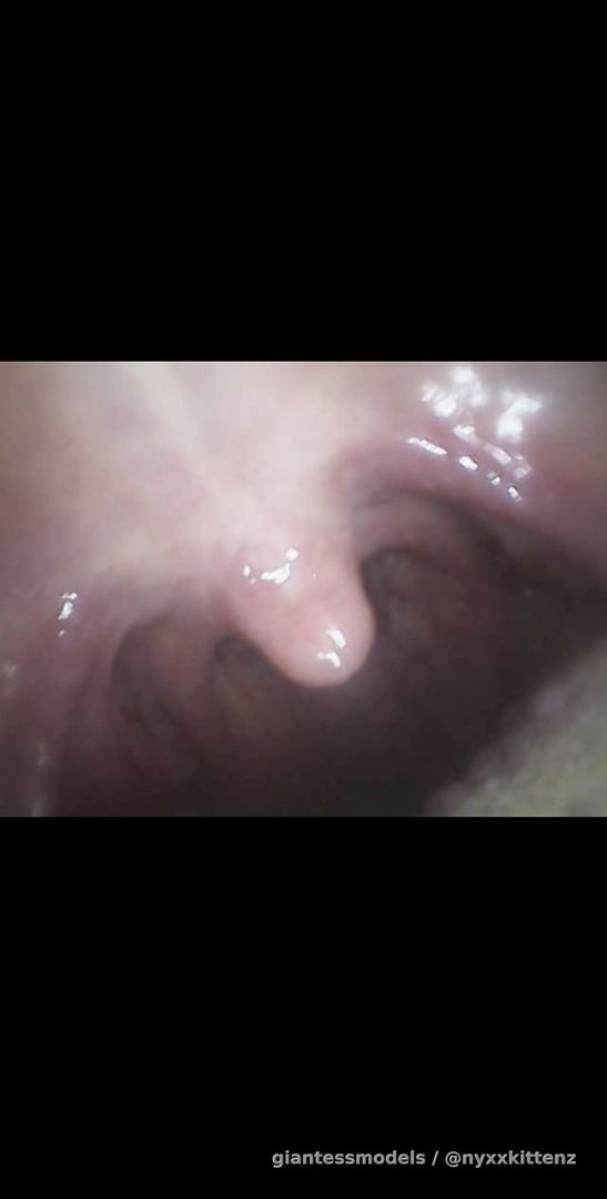 💜 Hot tongue, uvula and tonsils views 💜 (endoscope)  