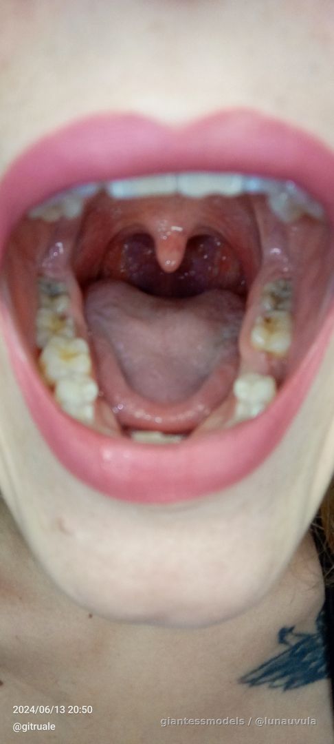 Photos My uvula mout tongue 