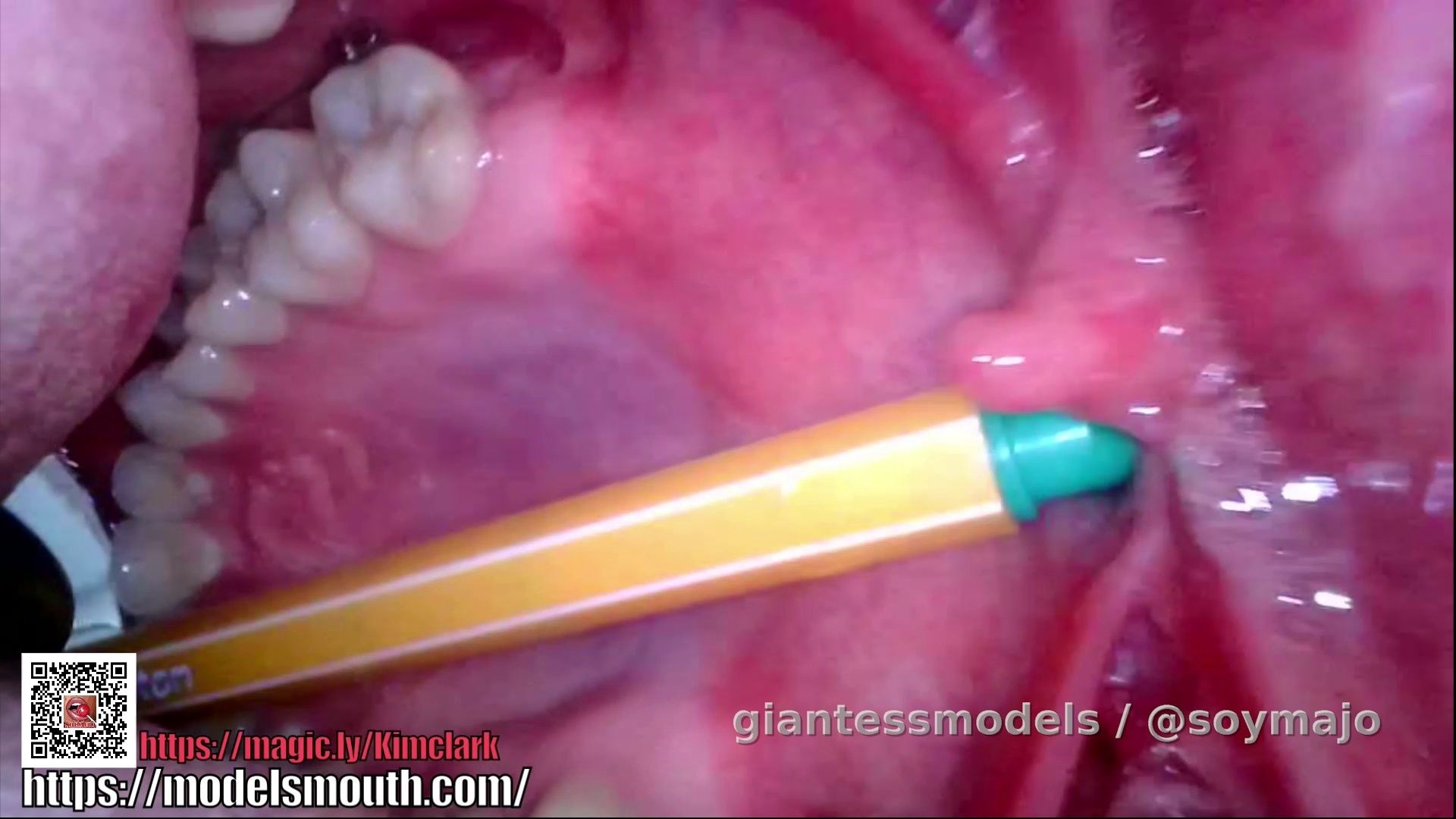 Endoscope tour with pen