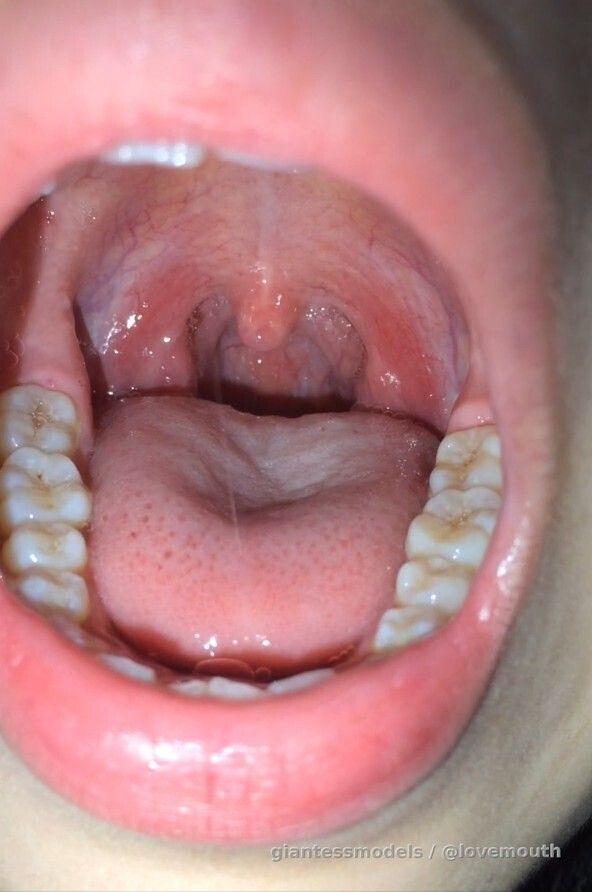 The girl kept irritating her throat, causing her to gag.