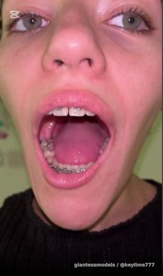 DEVOURING Gummy Bears, Close Up Throat and Uvula 