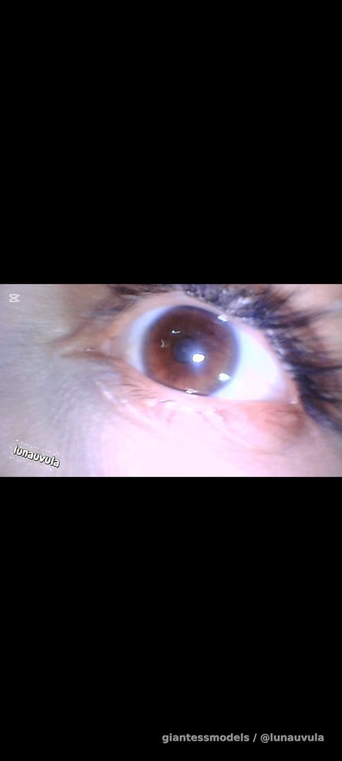 Food with endoscopy