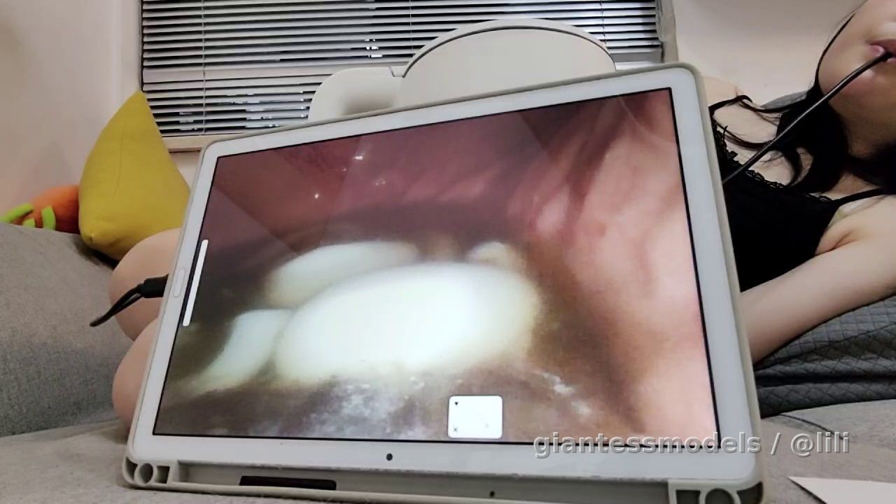 Endoscope stomach tour