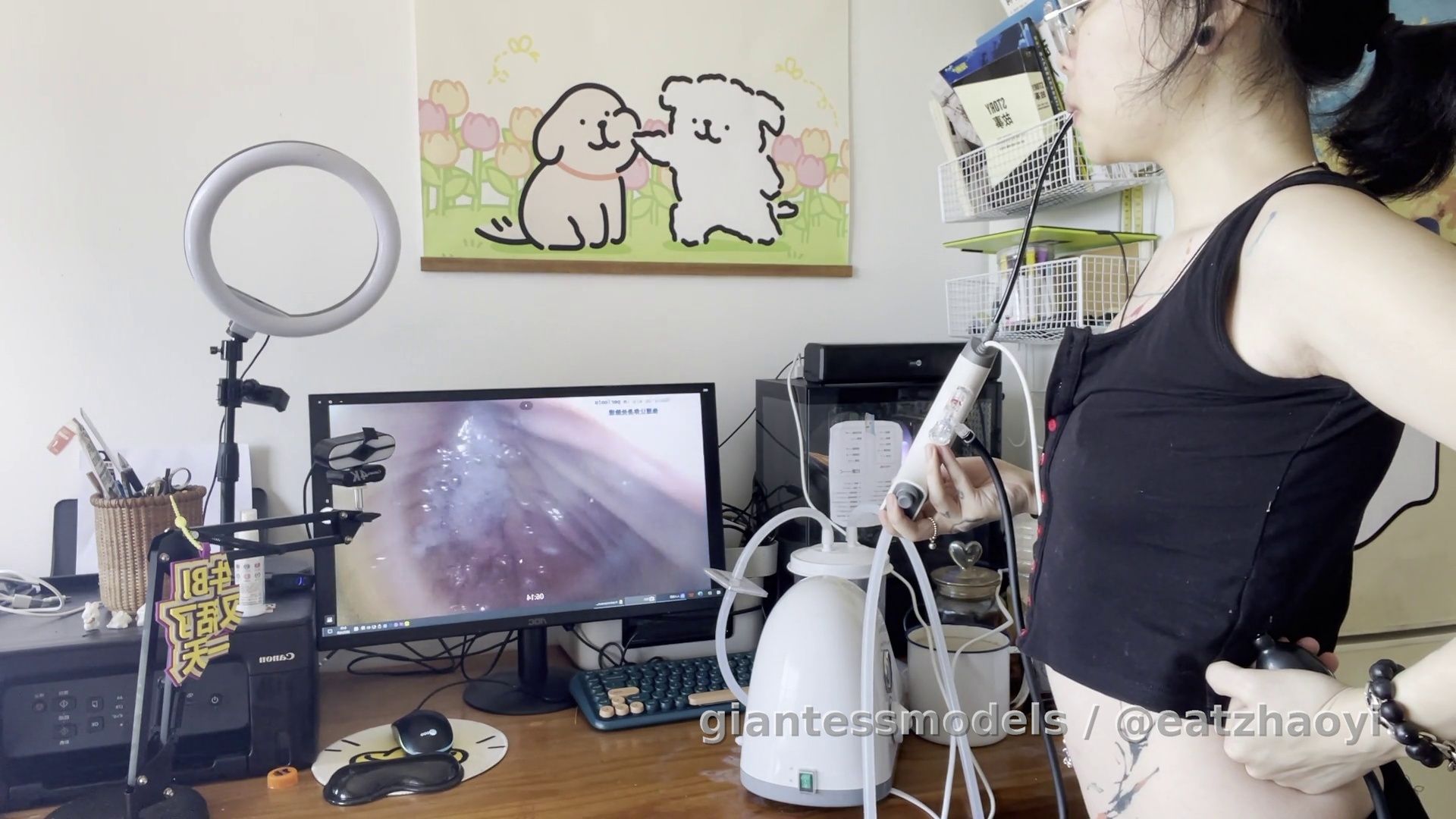 2025.4.8体外视角➕半个多小时用负压泵配合内窥管清理胃里泡沫（这一段体内没录上）➕吞了一瓣橘子以后再下内窥镜 1小时28分钟