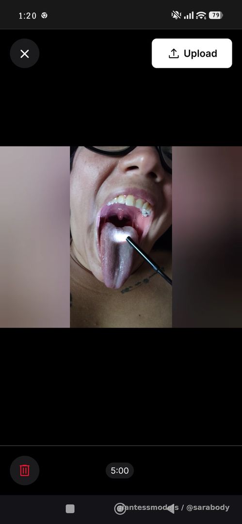 Explore my mouth with the endoscope 