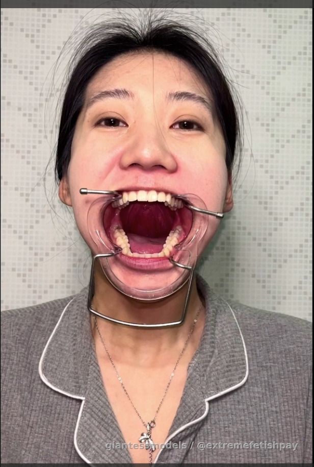 gagging and vomit, open mouth