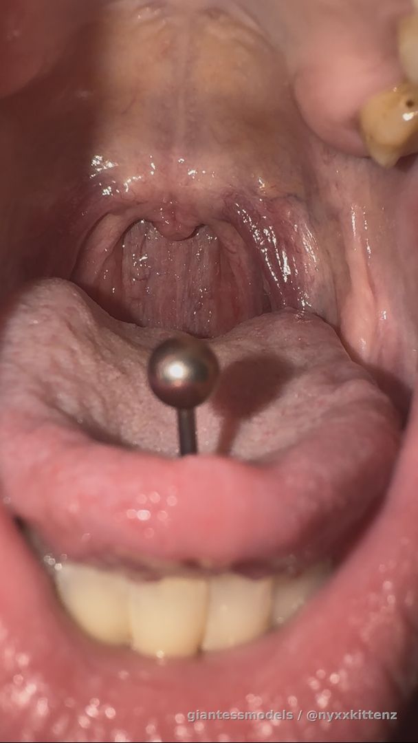 😮 watch my sore throat move as I make noises.  Blisters on my throat is an added bonus. Haha! 