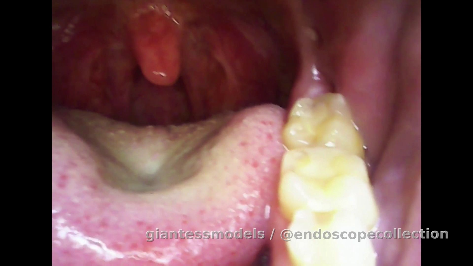 Giantess endoscope