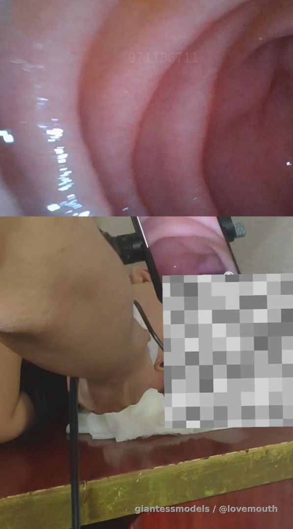 Gastroscopy for girls