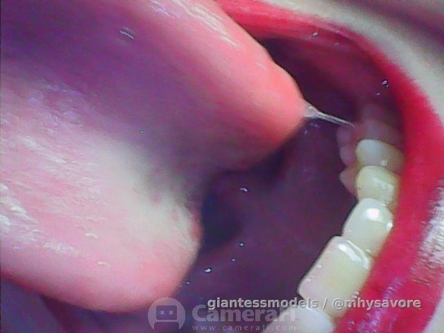 Endoscopy full bundle of 9 endoscopy content