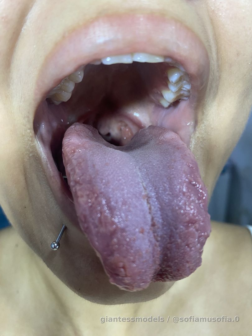 escribe al DM para personalizados