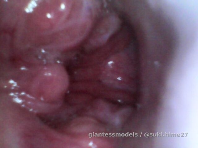 POV getting swallowed