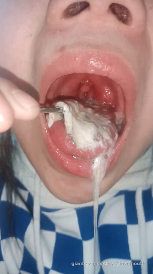 The girl kept irritating her throat, causing her to retch and vomit.