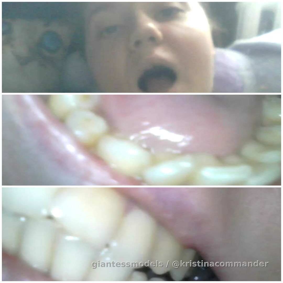 POV: A giantess came to the tiny doctor for a dental checkup. Each tooth was examined from different angles, but she brazenly grabbed and ate them... (Video 1:30)