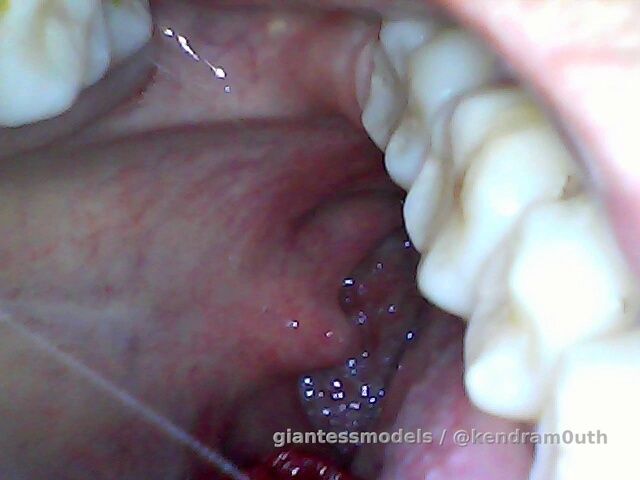 Endoscope mouth