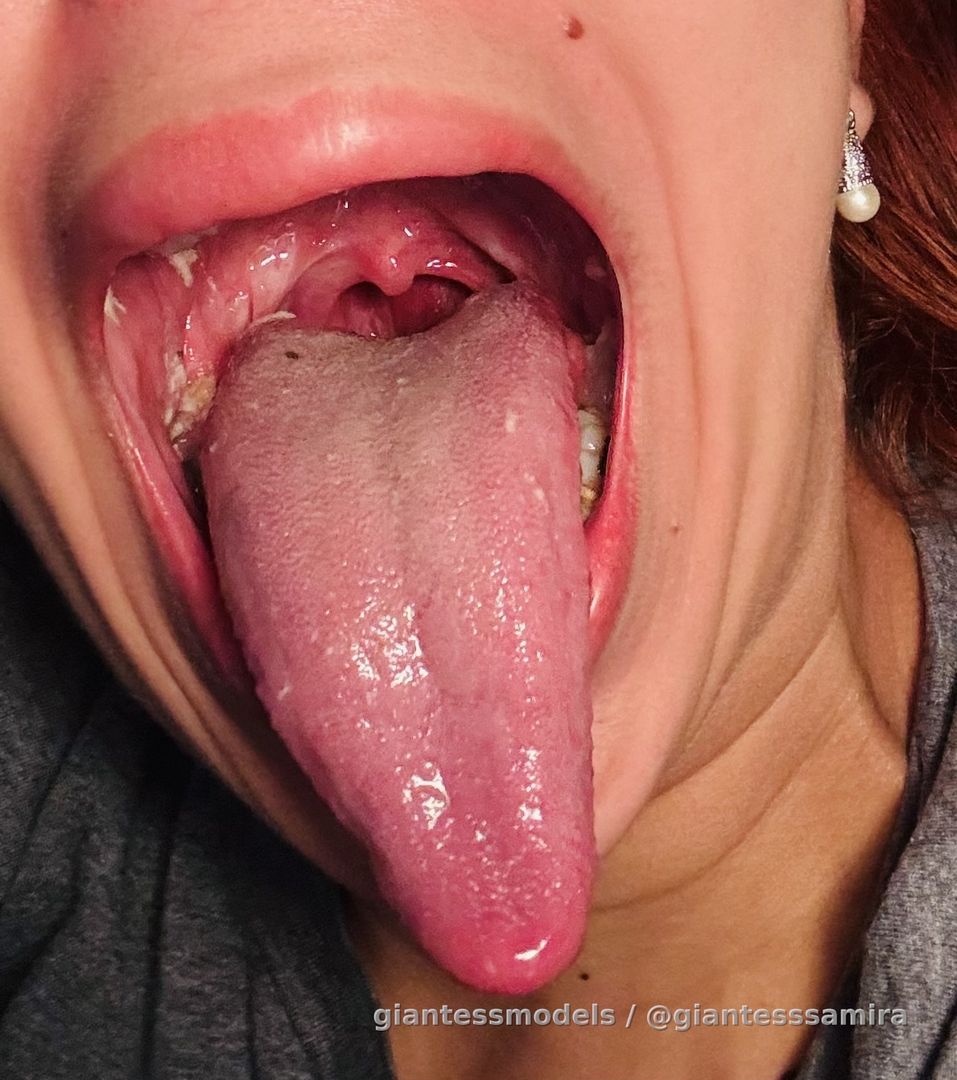 My tongue