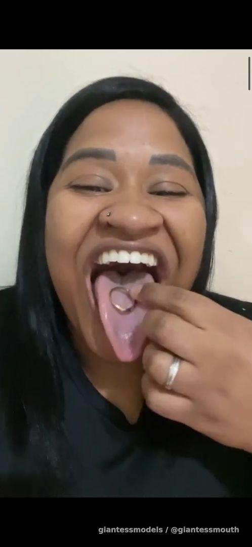Ring swallowed