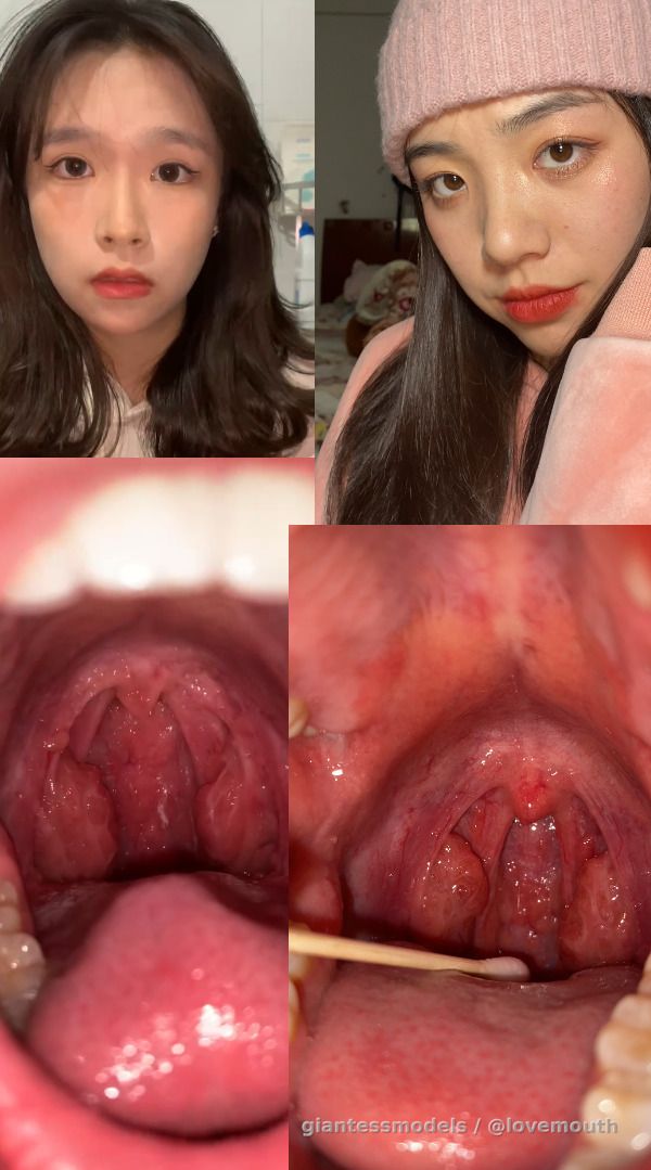 The oral cavity of 8 girls