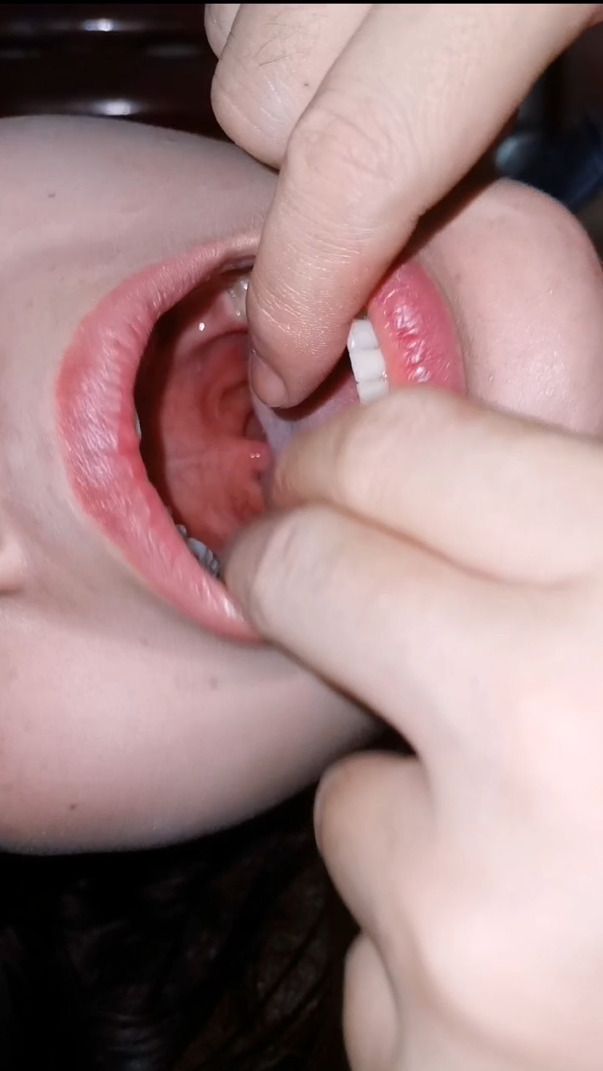 Oral examination of two girls