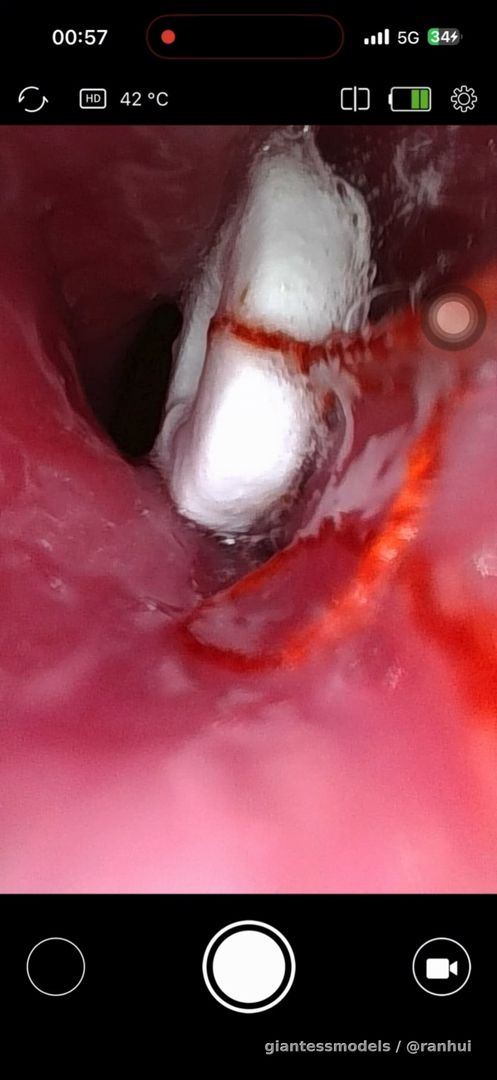 gastroscope Contact me if you need to purchase