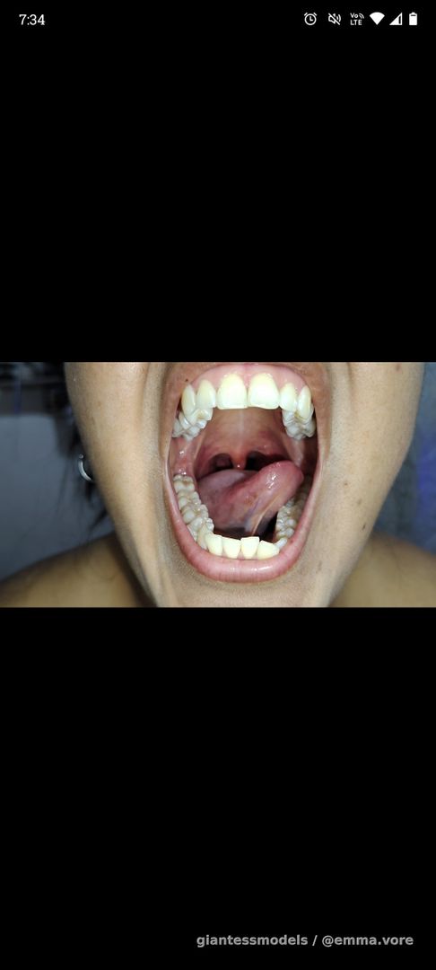 Tongue movement in the middle of the mouth