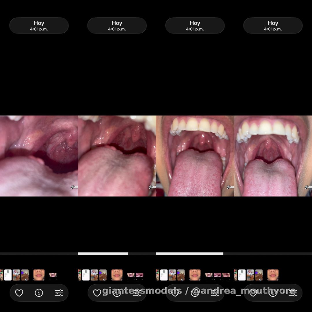 See my tonsils uvula and mouth!