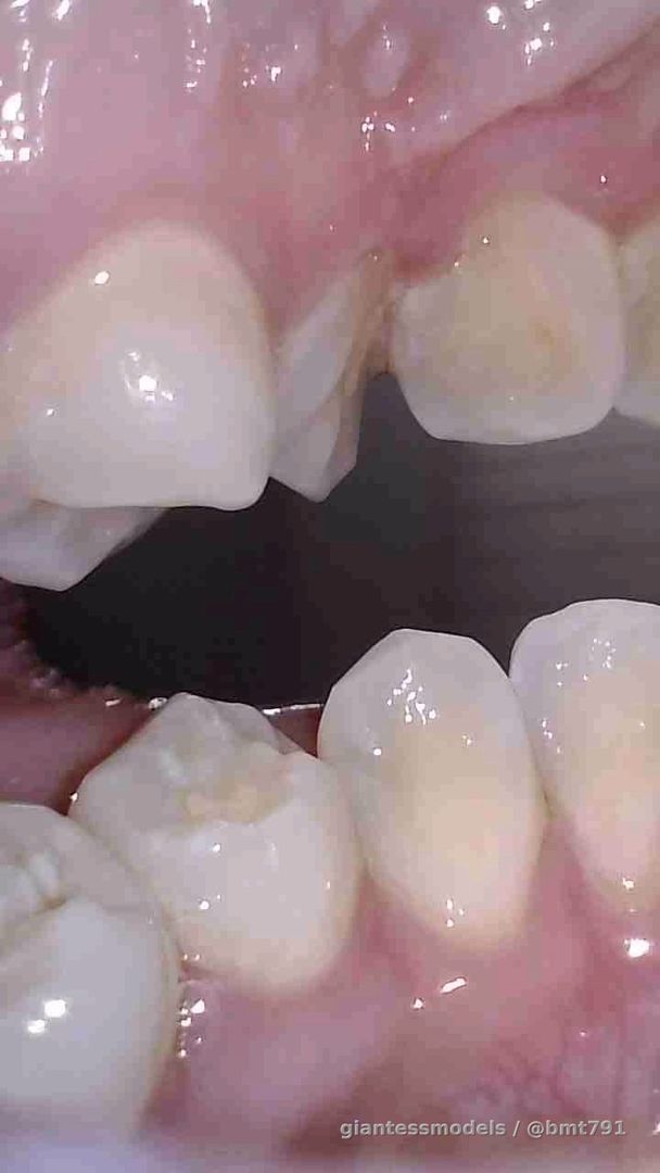 POV looking out of Tisia's mouth as she closes her teeth on you (sinus visible) 