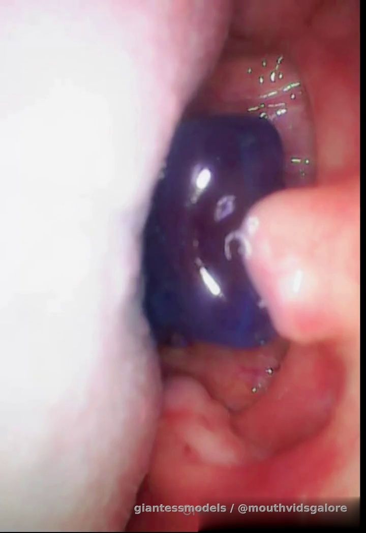 Oni Endoscopic Gummy Swallow