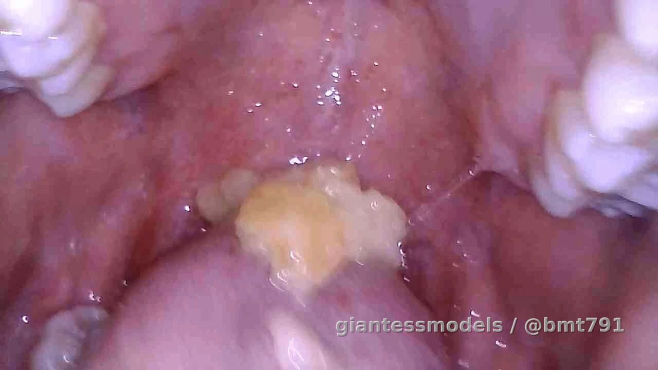 Watching apple chunks slide down her throat 