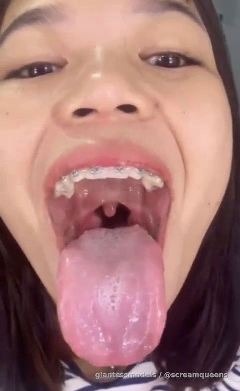 INSANE Extra Widee Juicy Uvula Viewz